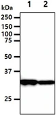 Anti-DECR1 antibody [AT3B2] used in Western Blot (WB). GTX57680