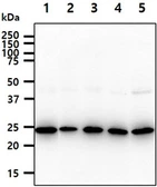 Anti-BAG2 antibody [AT29E9] used in Western Blot (WB). GTX57685