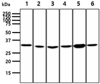 Anti-PPCS antibody [AT10D11] used in Western Blot (WB). GTX57689