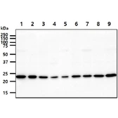 Anti-Adenylate kinase 1 antibody [AT7E9] used in Western Blot (WB). GTX57693