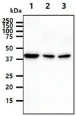 Anti-PPME1 antibody [AT29G3] used in Western Blot (WB). GTX57695