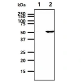 Anti-ALDH2 antibody [AT2C10] used in Western Blot (WB). GTX57696