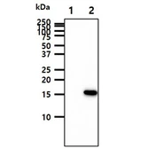 Anti-GMF beta antibody [AT44D8] used in Western Blot (WB). GTX57698