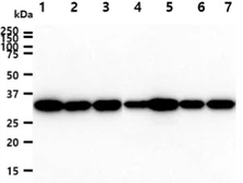 Anti-Cyclophilin E antibody [AT17E8] used in Western Blot (WB). GTX57706