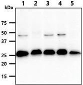 Anti-SSU72 antibody [AT45E2] used in Western Blot (WB). GTX57708