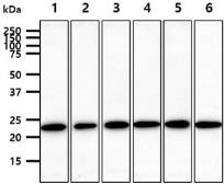 Anti-RAB7A antibody [AT10E4] used in Western Blot (WB). GTX57709