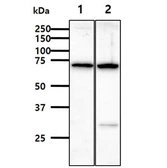 Anti-Alpha fetoprotein / AFP antibody [AT73E10] used in Western Blot (WB). GTX57721