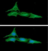 Anti-ATG3 antibody [AT15F6] used in Immunocytochemistry/ Immunofluorescence (ICC/IF). GTX57724