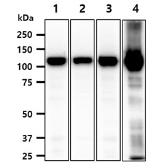 Anti-Hexokinase I + Hexokinase II + Hexokinase III antibody [AT4C12] used in Western Blot (WB). GTX57726