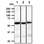 Anti-Calcineurin A antibody [AT1E11] used in Western Blot (WB). GTX57730