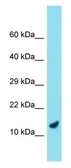 Anti-C9orf116 antibody used in Western Blot (WB). GTX57735
