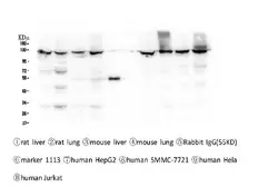 Anti-CRM1 antibody [5G3] used in Western Blot (WB). GTX57736