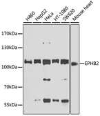 Anti-EphB2 antibody used in Western Blot (WB). GTX57740