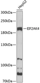 Anti-GCN2 antibody used in Western Blot (WB). GTX57741