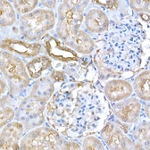Anti-GCN2 antibody used in IHC (Paraffin sections) (IHC-P). GTX57741