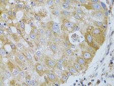 Anti-HDAC8 antibody used in IHC (Paraffin sections) (IHC-P). GTX57746