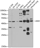 Anti-JAM-B antibody used in Western Blot (WB). GTX57748