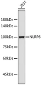 Anti-NALP6 antibody used in Western Blot (WB). GTX57752