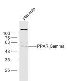 Anti-PPAR gamma antibody used in Western Blot (WB). GTX57756