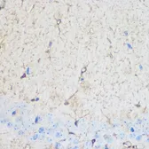 Anti-S100 beta antibody used in IHC (Paraffin sections) (IHC-P). GTX57757