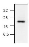 Anti-Caspase 6 (active) antibody used in Western Blot (WB). GTX59553