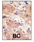 Anti-PI3 kinase p110 beta antibody, N-term used in IHC (Paraffin sections) (IHC-P). GTX59596