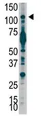Anti-PI3 kinase p110 beta antibody, C-term used in Western Blot (WB). GTX59597
