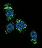 Anti-Glucokinase antibody, N-term used in Immunocytochemistry/ Immunofluorescence (ICC/IF). GTX59598