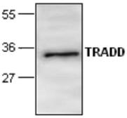 Anti-TRADD antibody used in Western Blot (WB). GTX59659