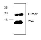 Anti-C5 / C5a antibody [561] used in Western Blot (WB). GTX59696