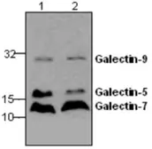 Anti-Galectin 9 antibody used in Western Blot (WB). GTX59744