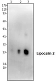 Anti-Lipocalin-2 antibody used in Western Blot (WB). GTX59781