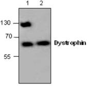 Anti-Dystrophin antibody used in Western Blot (WB). GTX59790