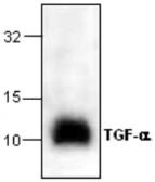 Anti-TGF alpha antibody used in Western Blot (WB). GTX59851