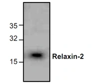Anti-Relaxin 2 antibody used in Western Blot (WB). GTX59859