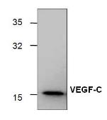 Anti-VEGFC antibody used in Western Blot (WB). GTX59914