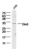 Anti-DIO3 antibody used in Western Blot (WB). GTX60156