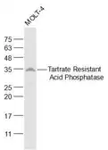 Anti-TRAP antibody used in Western Blot (WB). GTX60167