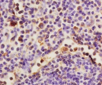 Anti-HAS1 antibody used in IHC (Paraffin sections) (IHC-P). GTX60186
