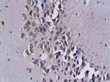 Anti-CXCL16 antibody used in IHC (Paraffin sections) (IHC-P). GTX60199
