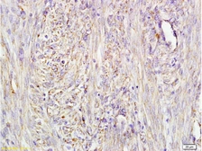 Anti-Alpha fetoprotein / AFP antibody [A4] used in IHC (Paraffin sections) (IHC-P). GTX60215
