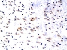 Anti-WIF1 antibody used in IHC (Paraffin sections) (IHC-P). GTX60226