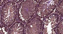 Anti-LBX1 antibody used in IHC (Paraffin sections) (IHC-P). GTX60263