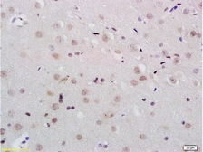 Anti-KDM5B antibody used in IHC (Paraffin sections) (IHC-P). GTX60284