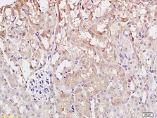 Anti-ST2 antibody used in IHC (Paraffin sections) (IHC-P). GTX60302