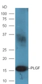 Anti-PIGF antibody used in Western Blot (WB). GTX60318