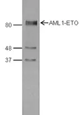 Anti-AML1-ETO antibody - ChIP grade used in Western Blot (WB). GTX60339