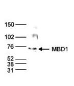 Anti-MBD1 antibody - ChIP grade used in Western Blot (WB). GTX60359