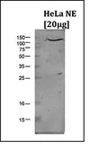 Anti-LSD1 antibody - ChIP grade used in Western Blot (WB). GTX60362