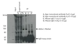 Anti-Argonautes antibody [GT9003] used in Immunoprecipitation (IP). GTX60370